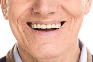 4 Dúvidas sobre saúde bucal na terceira idade